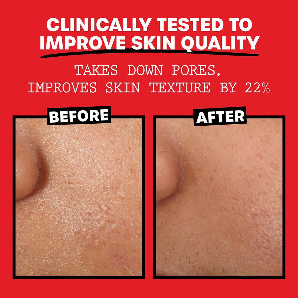 THAYERS Alcohol-Free Toner pack indicates non-drying, daily use.