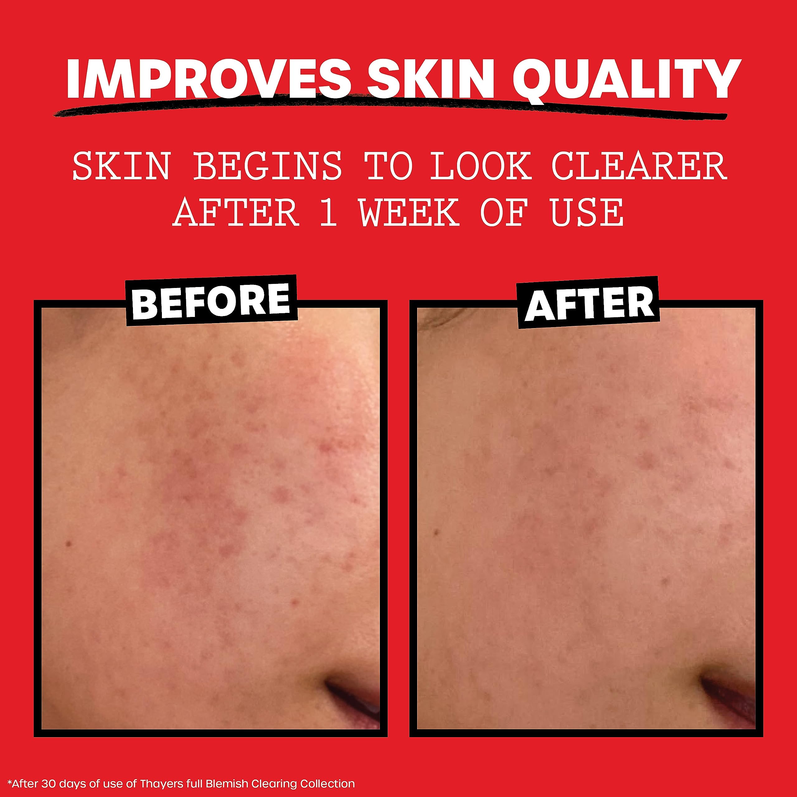 THAYERS Witch Hazel Aloe Tea Tree Oil ingredients support hydration and clarity.