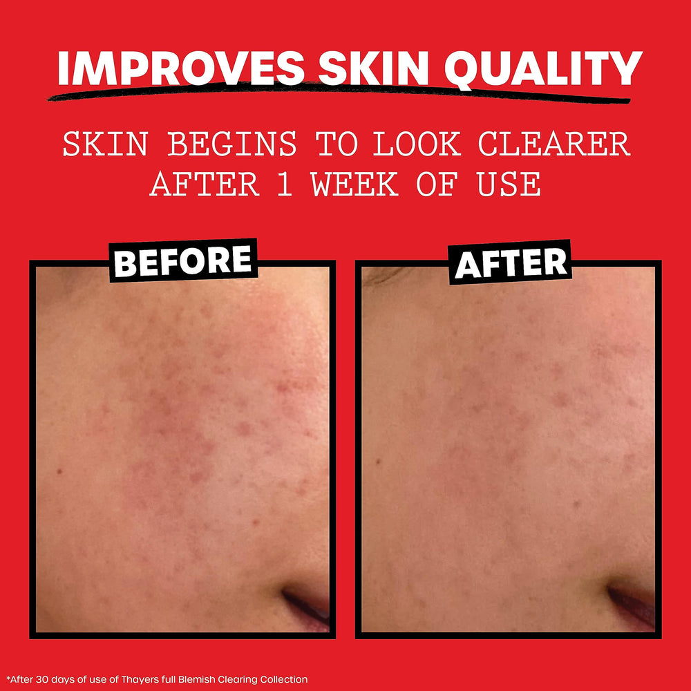 THAYERS Witch Hazel Aloe Tea Tree Oil ingredients support hydration and clarity.