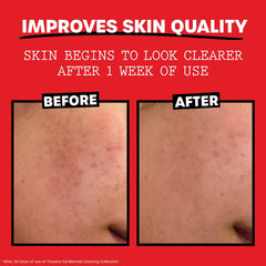 THAYERS Witch Hazel Aloe Tea Tree Oil ingredients support hydration and clarity.