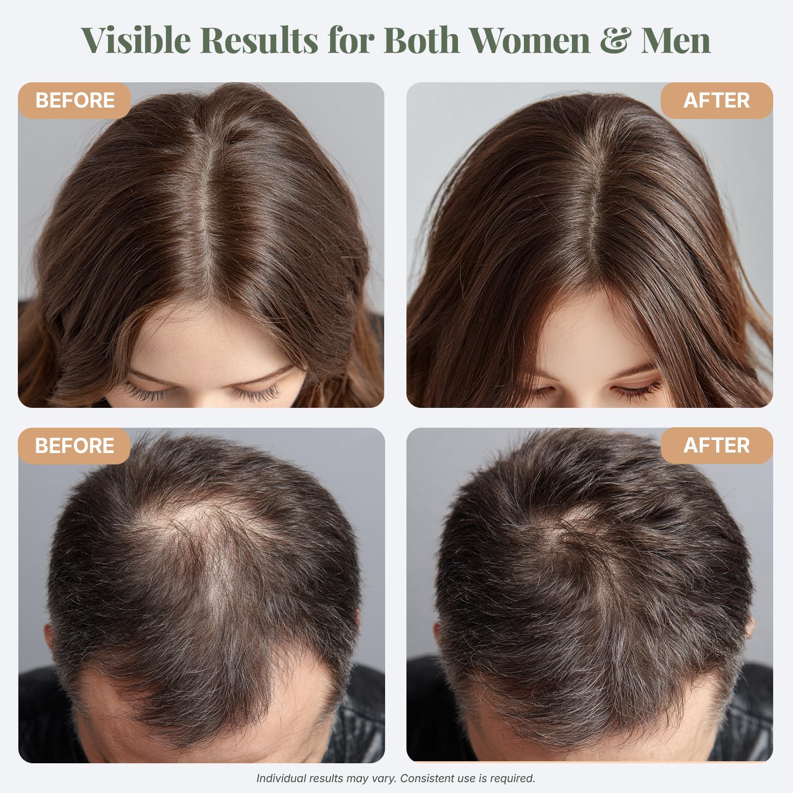 The ELIX rosemary oil hair application scene conveys nourishment and potential thicker-looking hair.