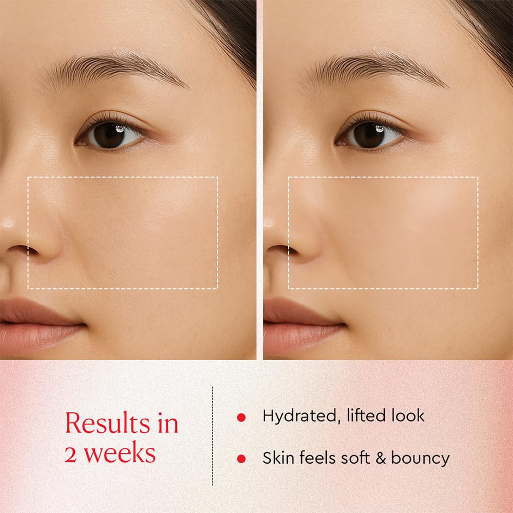 Moisture-rich appearance around the cheek area hints at improved skin plumpness.