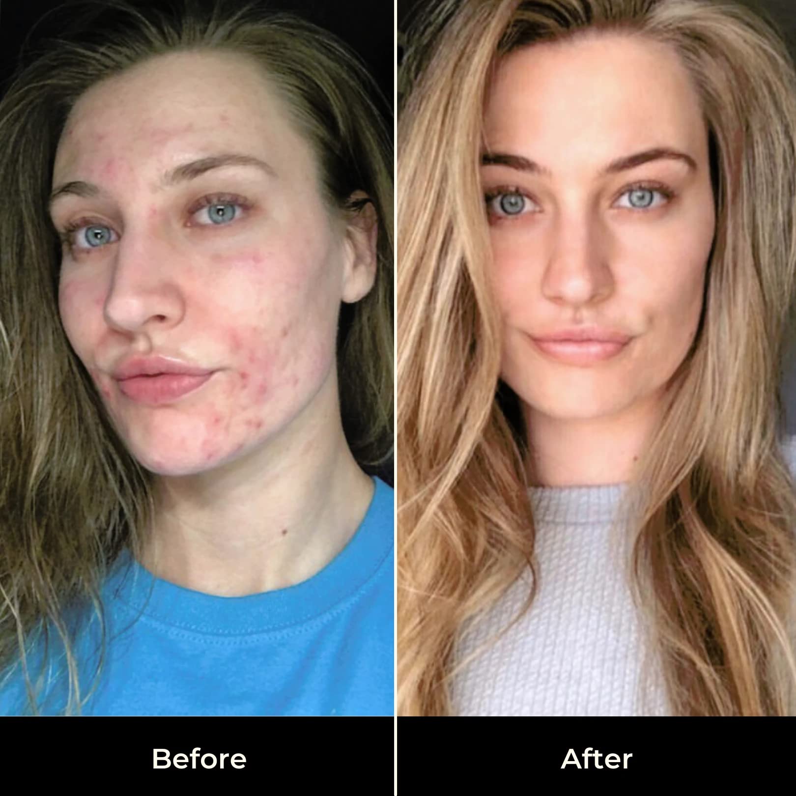 The Golden Secrets Youth Beauty Face Oil bottle resting on skin during routine
