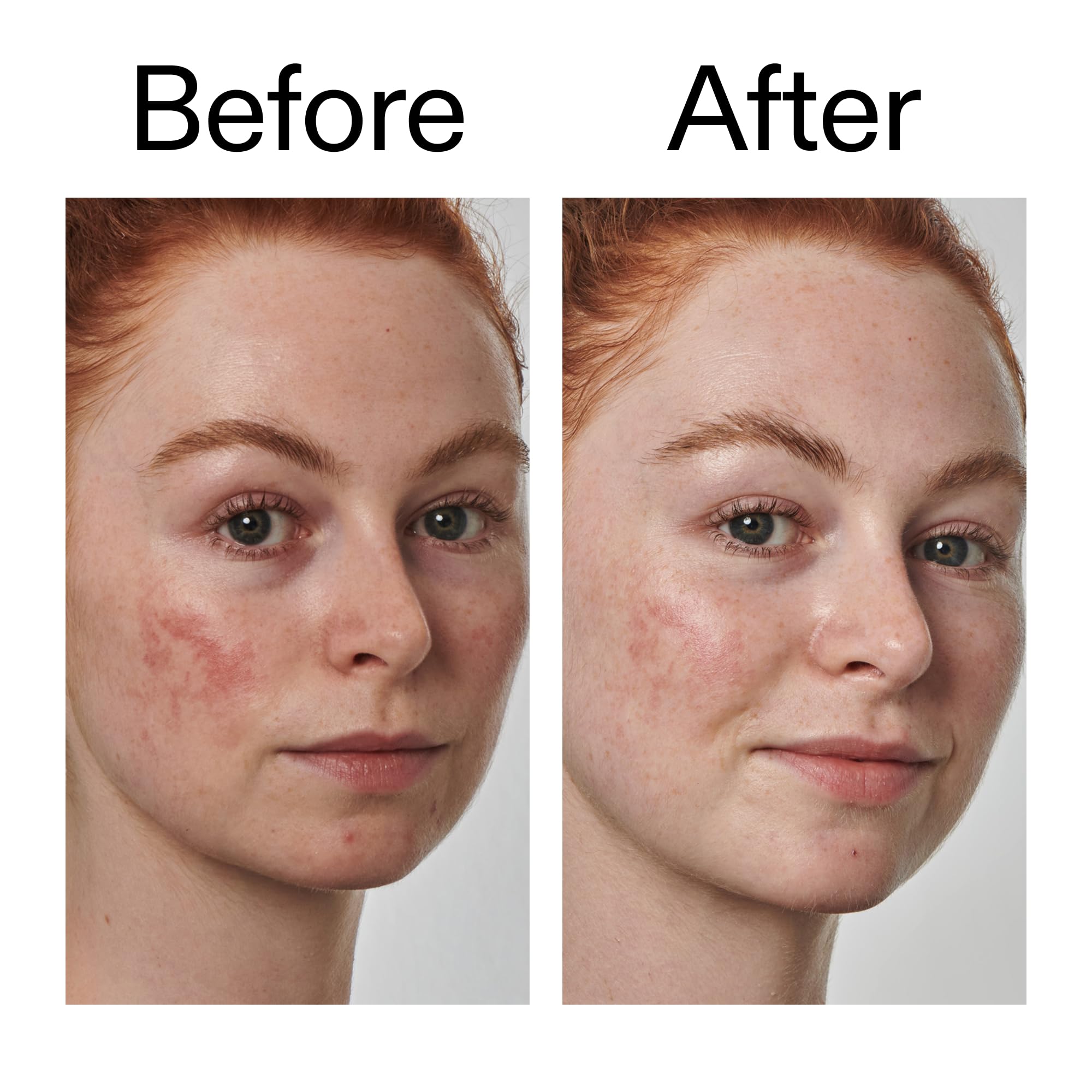 The INKEY List Azelaic Acid 10% Serum promoting even-toned skin benefits.