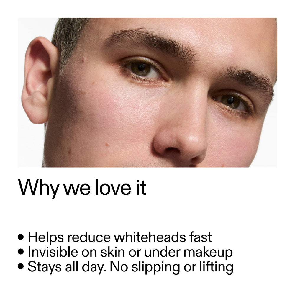 The INKEY List patch on skin offers invisible coverage while treating blemishes.