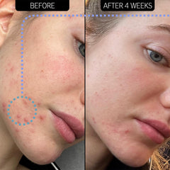 Novoretin 2% Moisturizer swirl on skin shows lightweight, non-greasy texture for overnight use