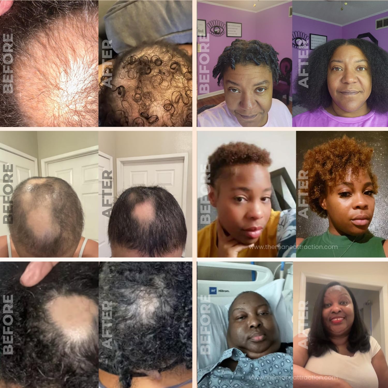 The Mane Attraction hair-growth visual suggests stronger, longer strands.