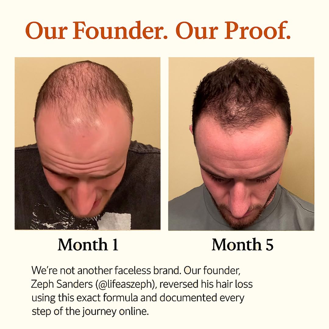 Dropper tip dispensing The Mane Elixir Blend onto thinning areas for precision