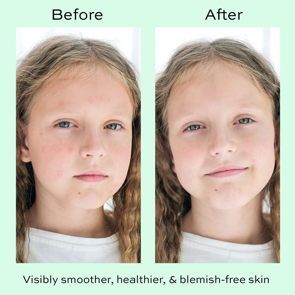The Natural and Organic Family kids skincare routine with fragrance-free moisturizer.