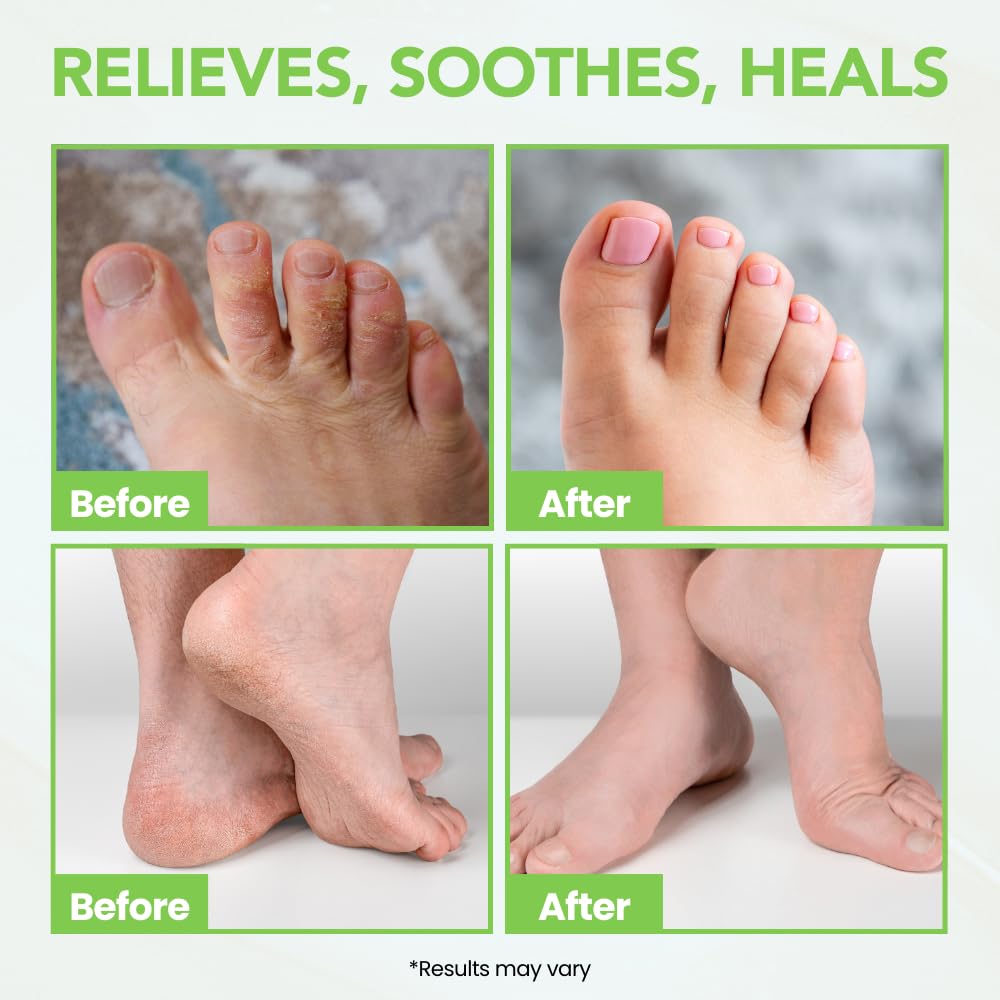 Thena ingredients like tea tree and neem highlighted for natural plant-based care.