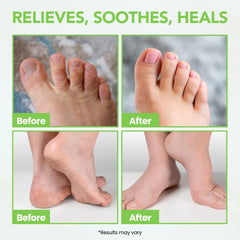 Thena ingredients like tea tree and neem highlighted for natural plant-based care.