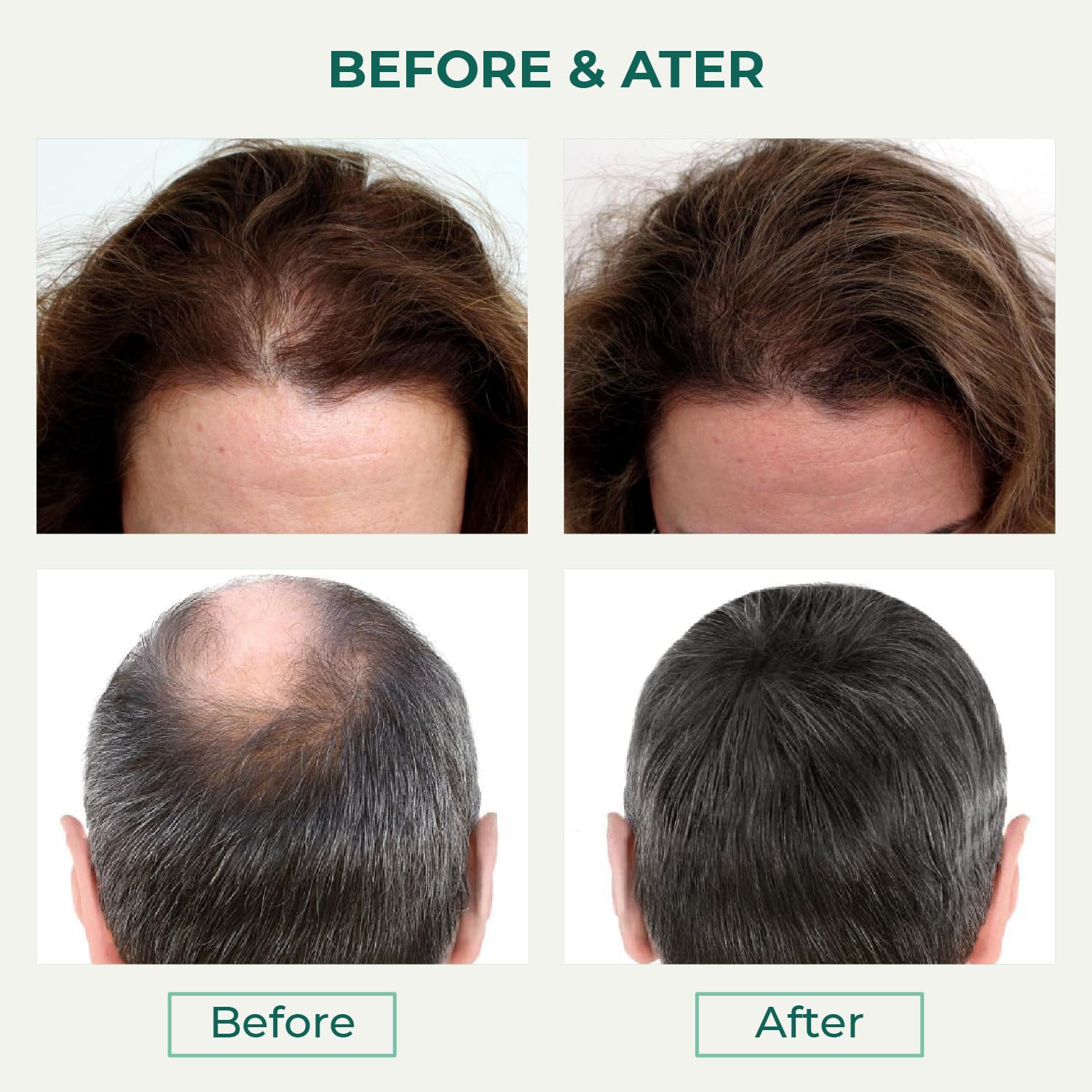 Thik&Fix scalp care formula nourishes roots