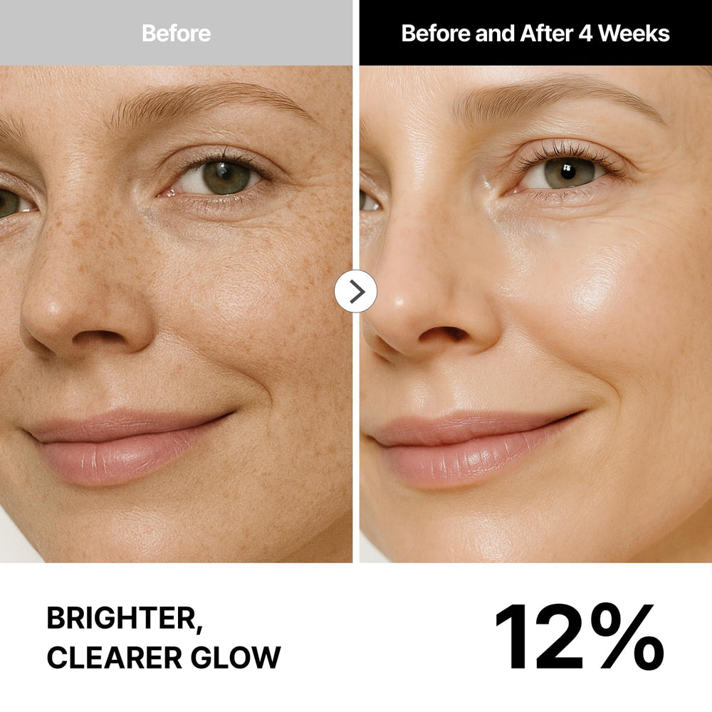 THOME G-Peel Kit Refine step closeup highlights prep for brighter, refined texture.