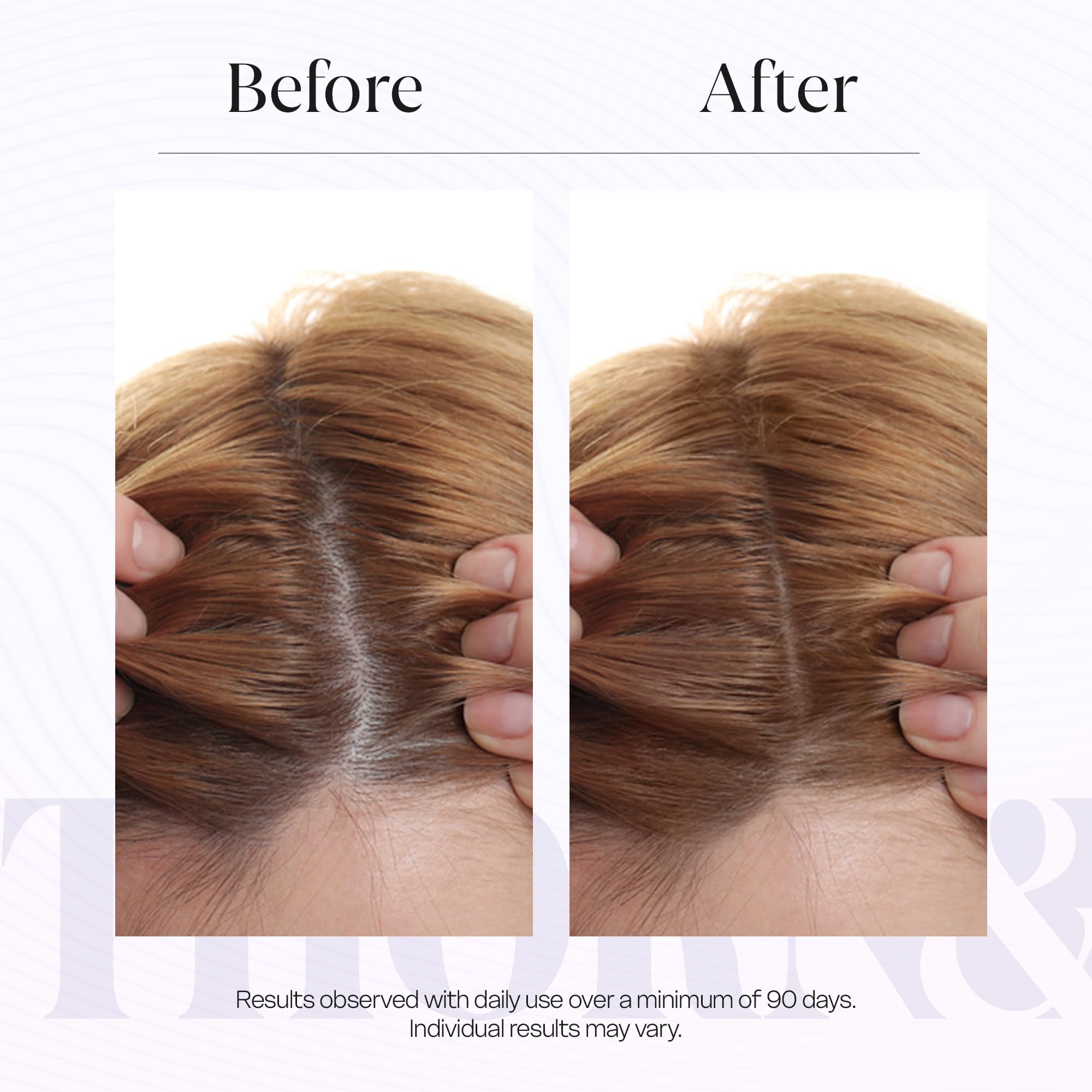 Thorn & Berry application ritual promotes refreshing scalp feel