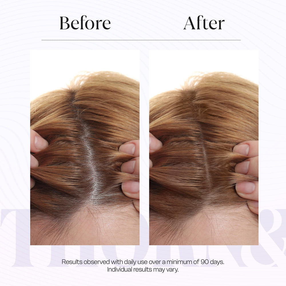 Thorn & Berry application ritual promotes refreshing scalp feel