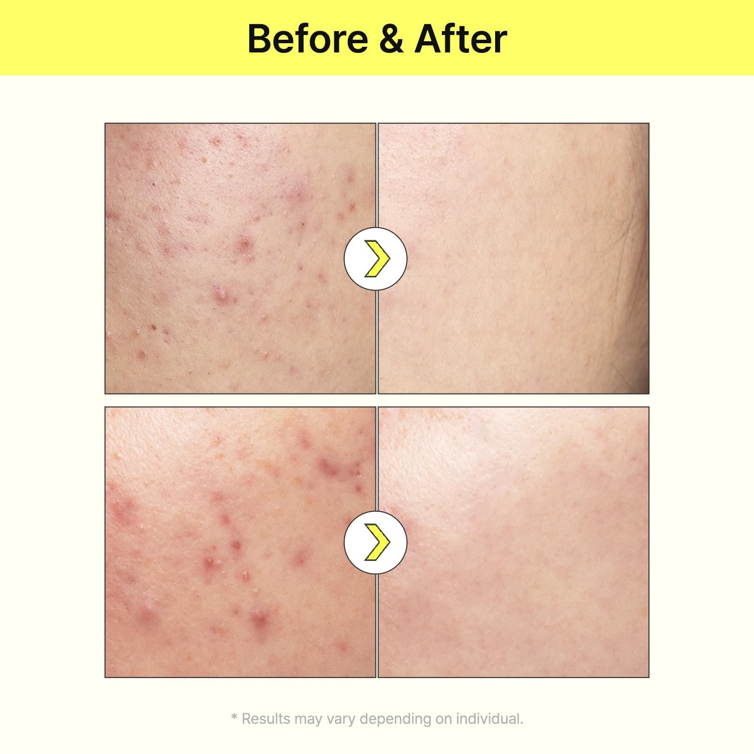 TIAM Vita B3 Source Serum applied on face during morning routine for glow