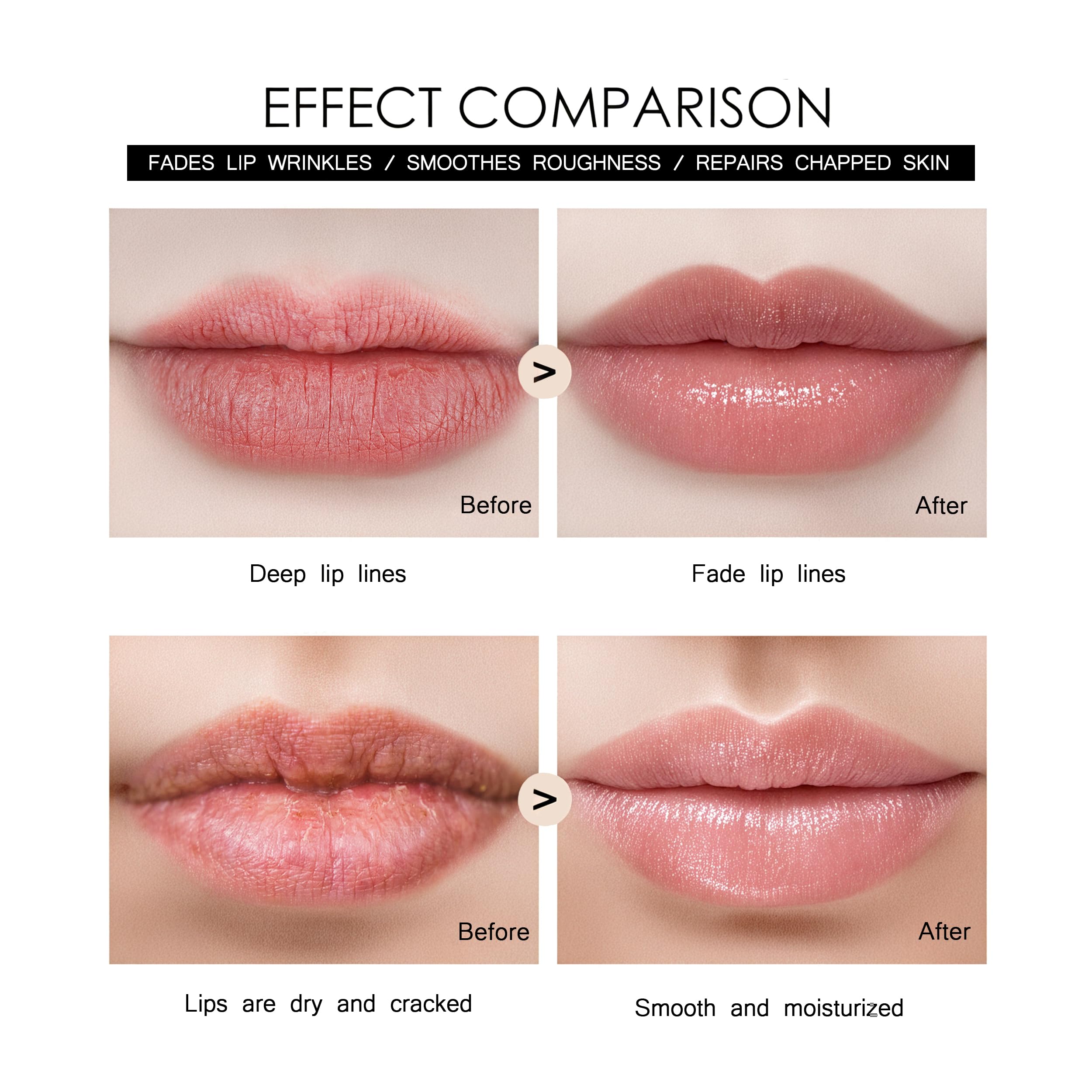 Tidewish Derma Roller lip plumping focus for smoother lips.