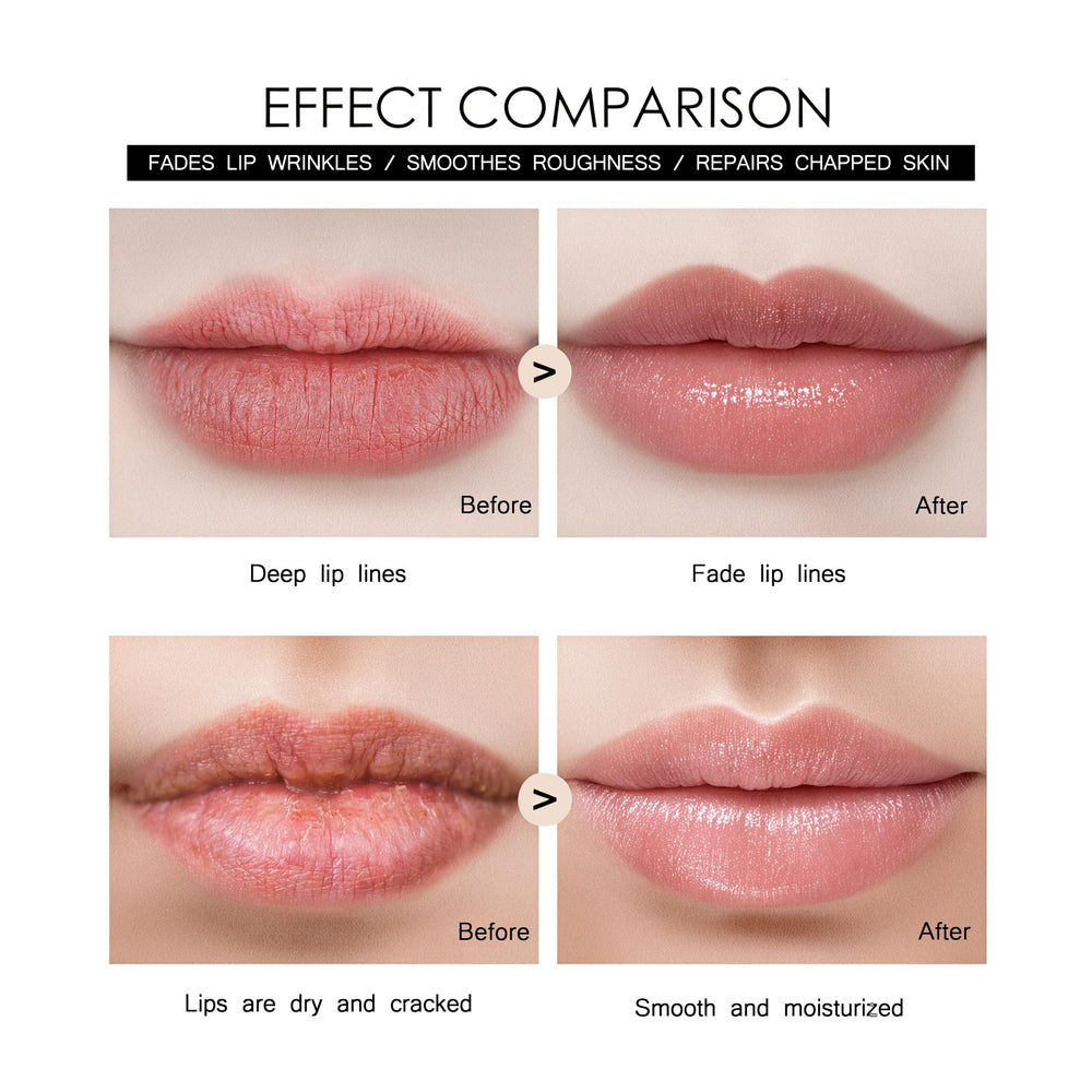 Tidewish Derma Roller lip plumping focus for smoother lips.