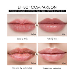 Tidewish Derma Roller lip plumping focus for smoother lips.
