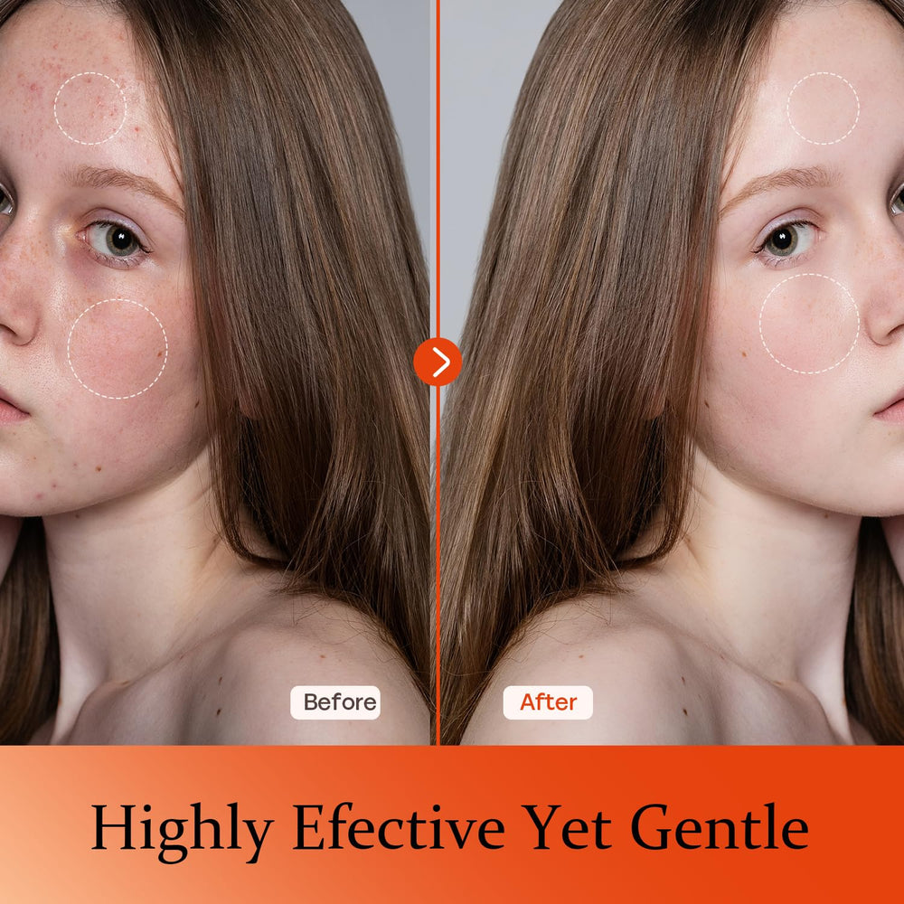 Tinclen Vitamin C Serum being applied to skin demonstrates quick absorption.