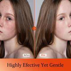 Tinclen Vitamin C Serum being applied to skin demonstrates quick absorption.