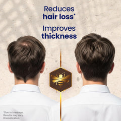 Tio Nacho rosemary extract drops highlighting refreshing scalp care.