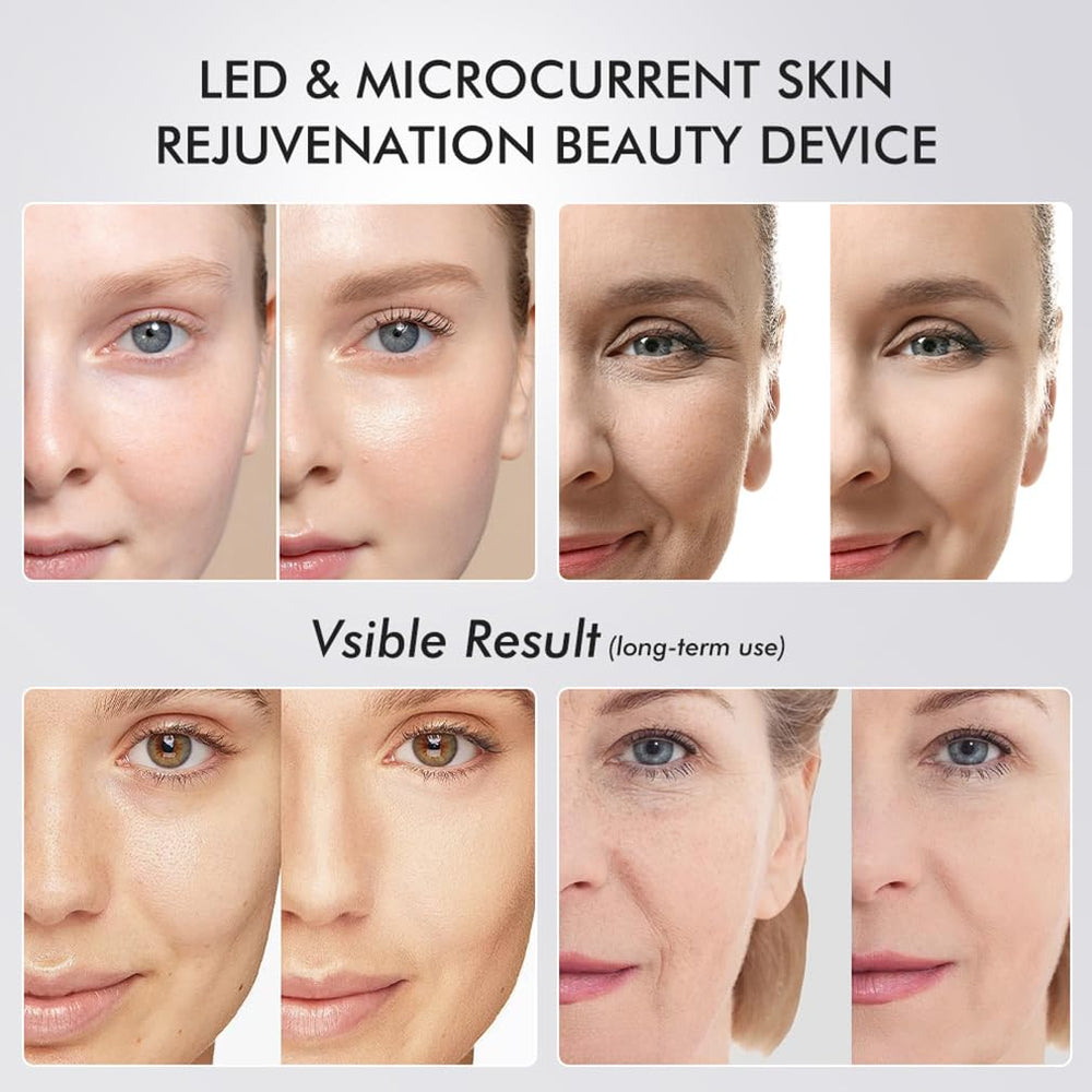 Tirisia device used without conductive gel for convenient skincare routine