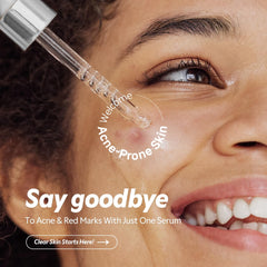 TIRTIR Azelaic Acid 12% Serum texture close-up shows lightweight hydration.
