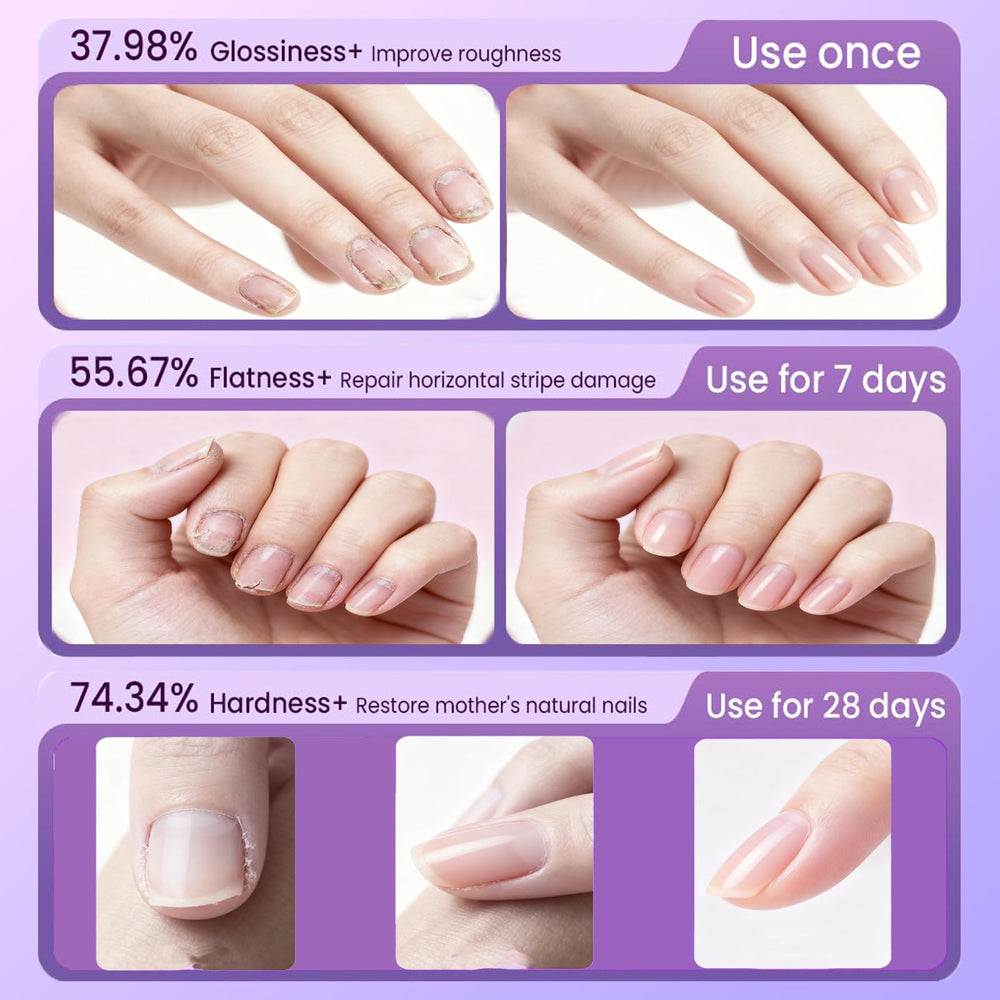TIUSUTA Nail care pen helps with hangnails and dryness.