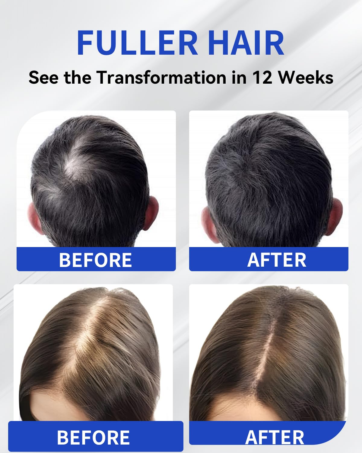 TJE Hair Growth Serum Roll-On scalp massage demonstrates quick absorption.