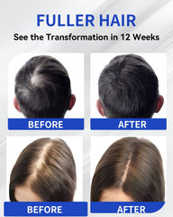 TJE Hair Growth Serum Roll-On scalp massage demonstrates quick absorption.