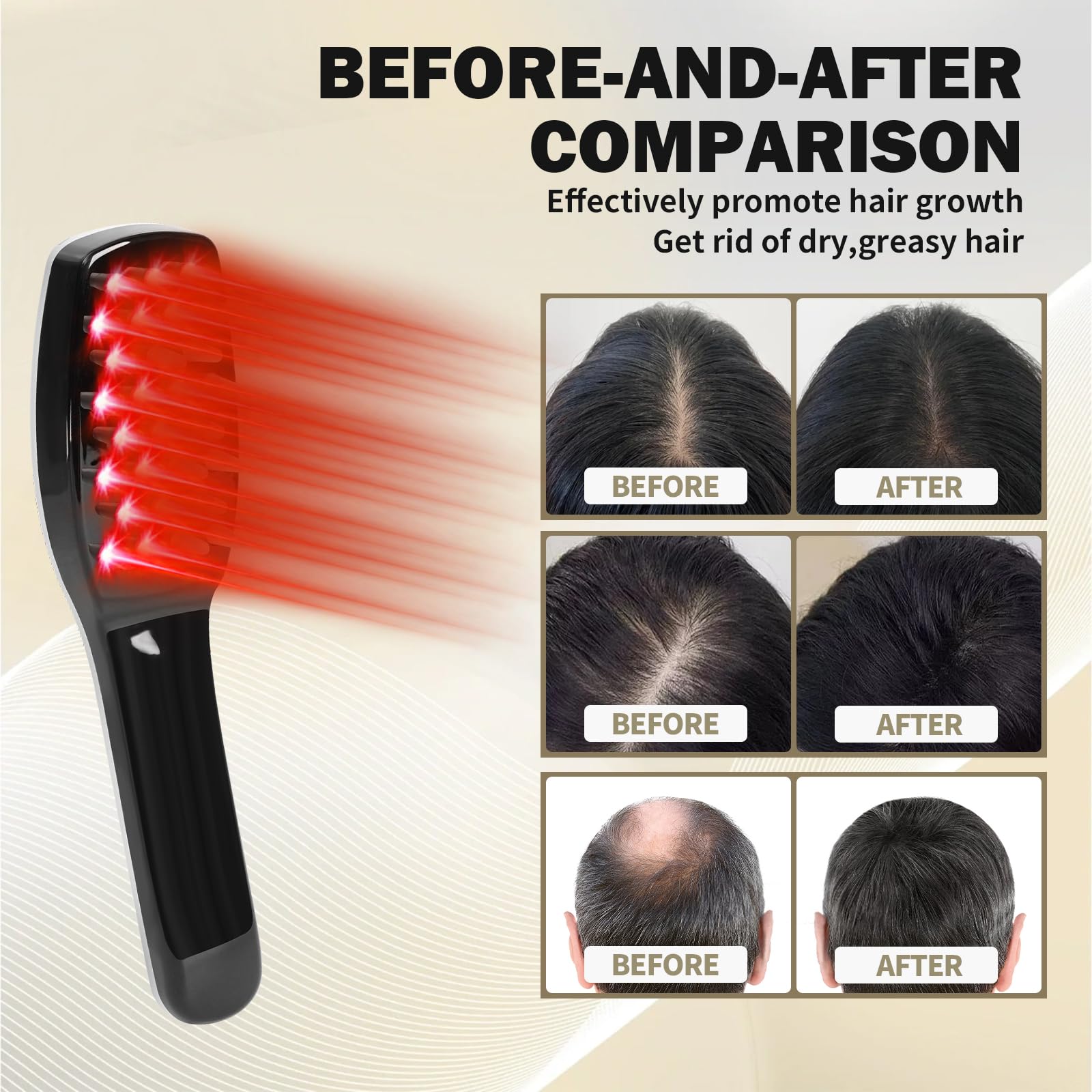 Tkcsoi Laser Comb kit includes unit and power cable.