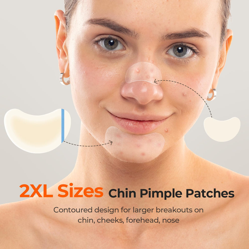 TKTK chin-patch round 8mm on chin targets small blemishes.