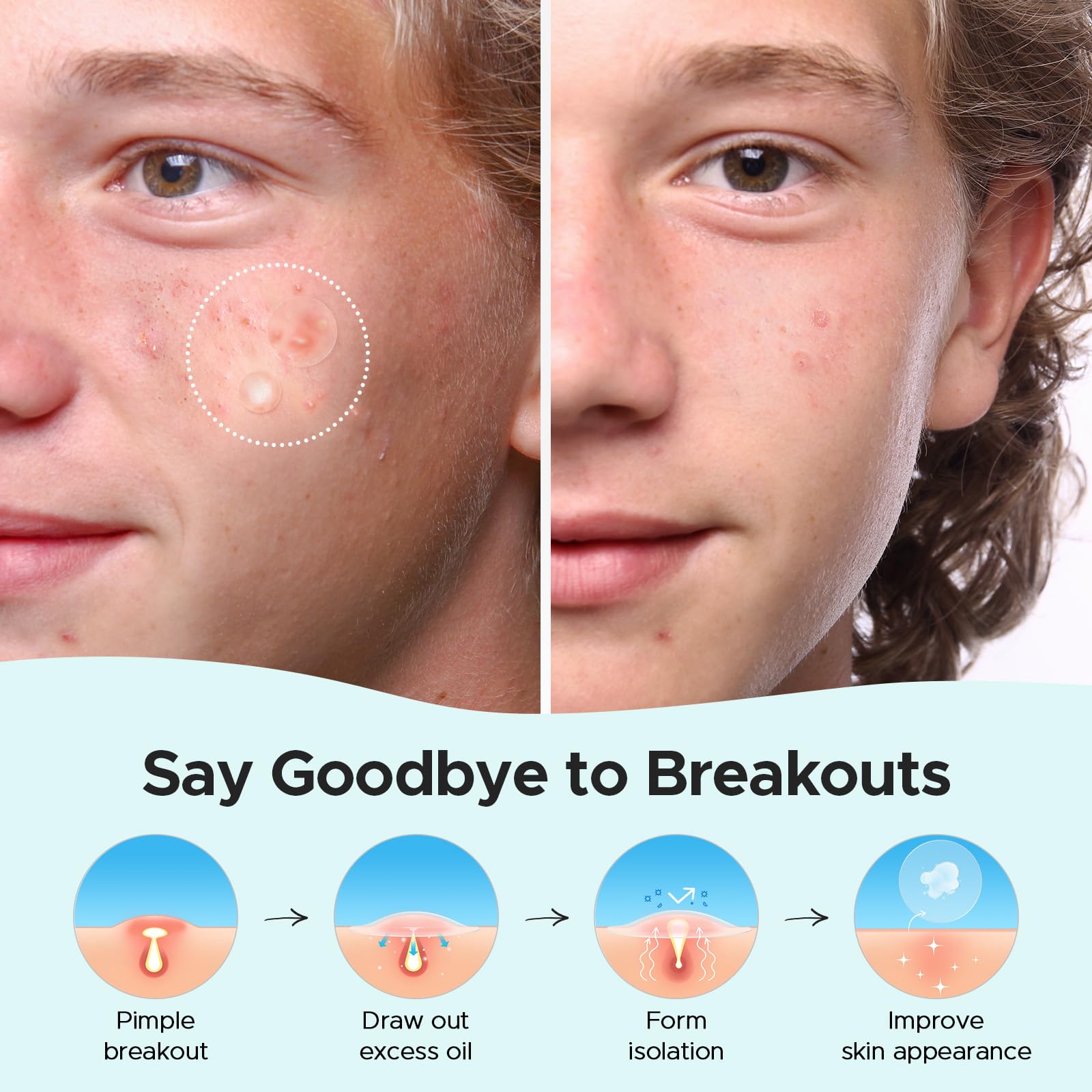 TKTK easy-peel film patches remove cleanly without tugging