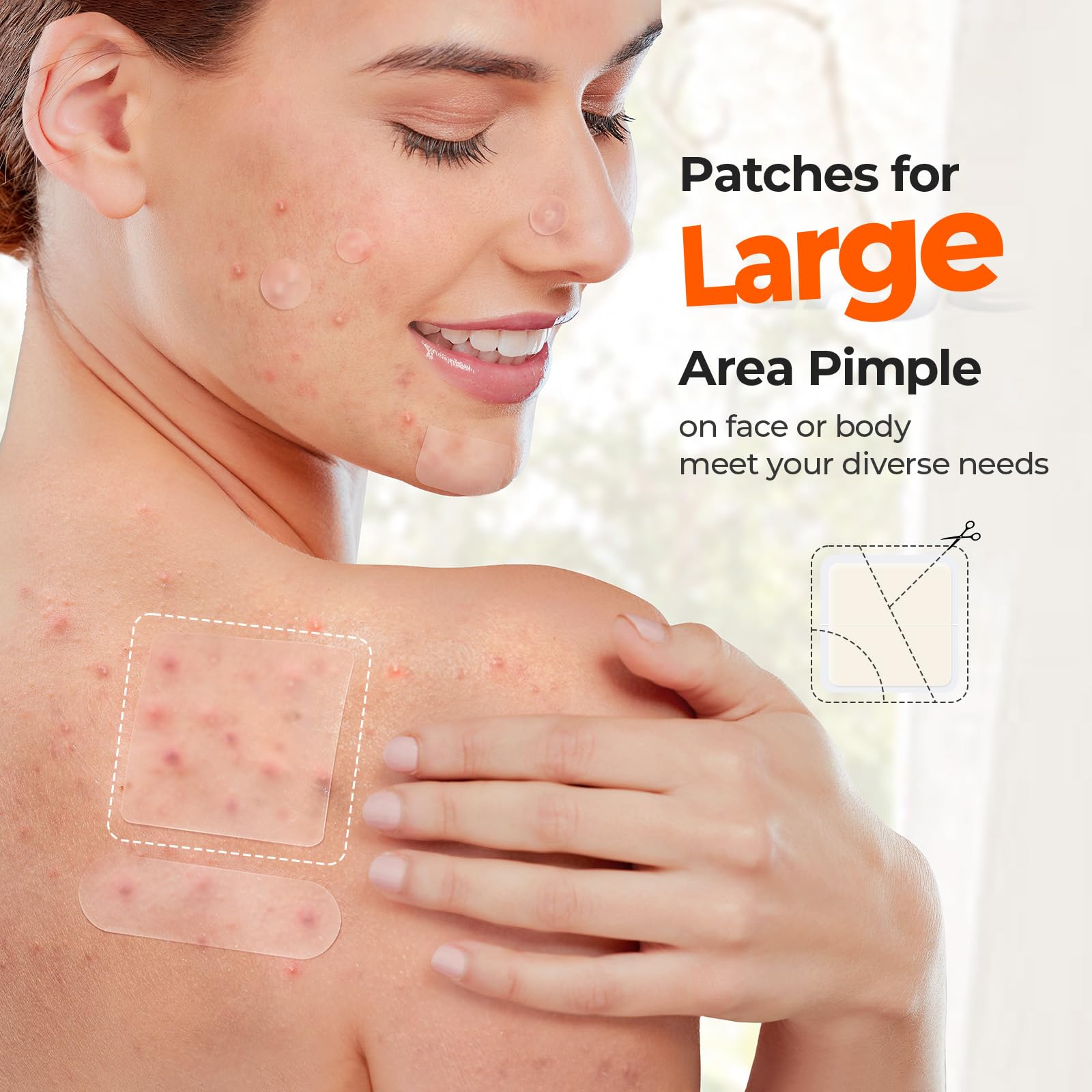 TKTK 8mm spot patch for precise coverage of small pimples.