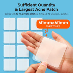 TKTK pimple patch 10mm covers medium blemishes with discreet comfort.