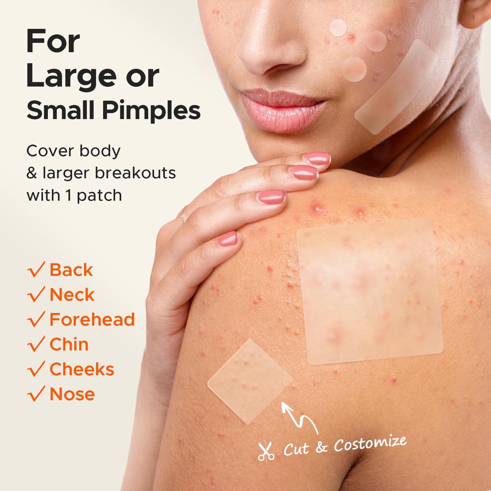 TKTK 12mm patch fits smaller zits with discreet clear backing.