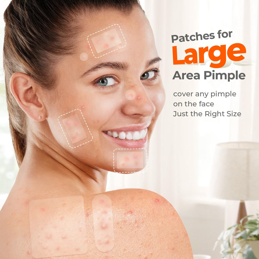 TKTK patches cover chin and forehead areas for larger blemishes with ease.