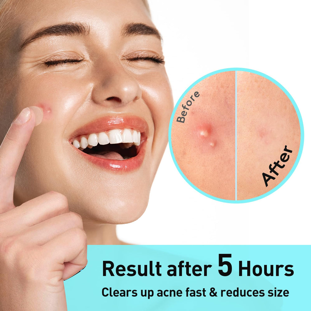 0.01 cm extra-thin edge ensures secure adhesion on skin.