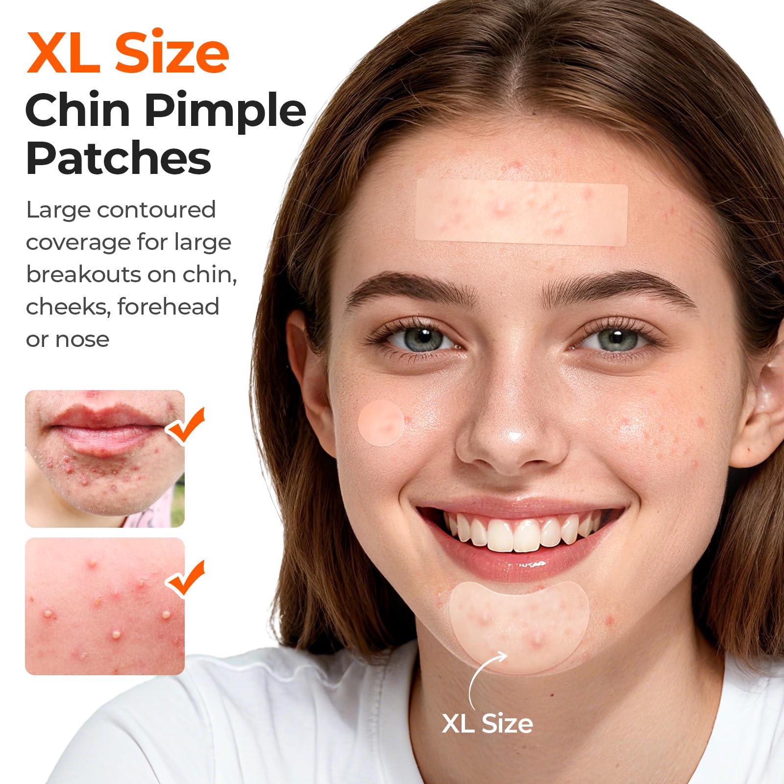 TKTK pore-cleaning stripe 60x20mm removes oil and impurities along pores