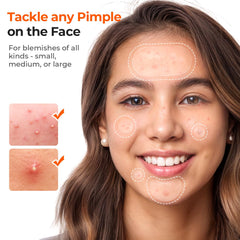 TKTK 8–10–12 mm spot patches fit small spots with precise coverage.