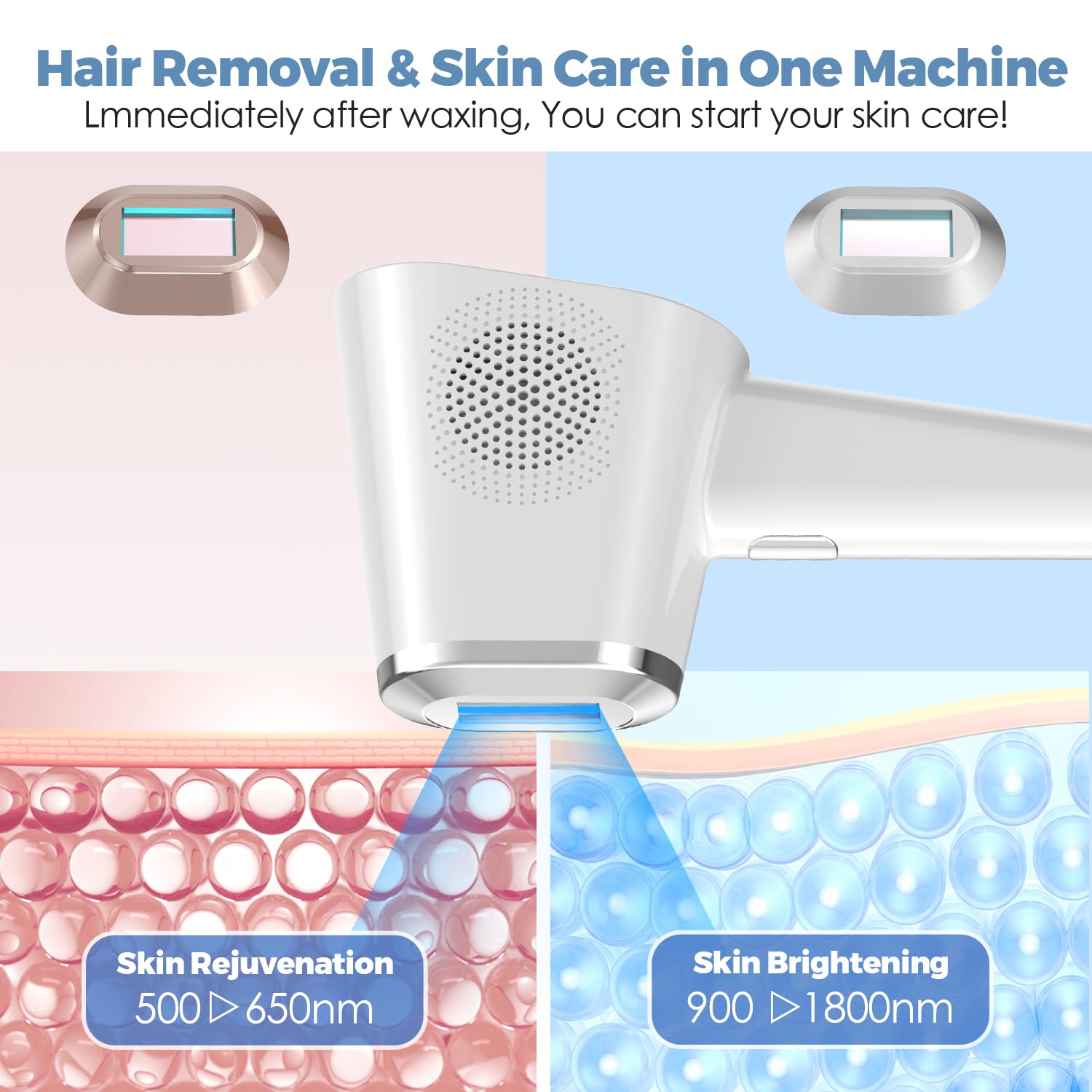 TMOMT OPT laser removal for arms reduces visible hair over time.