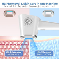 TMOMT OPT laser removal for arms reduces visible hair over time.
