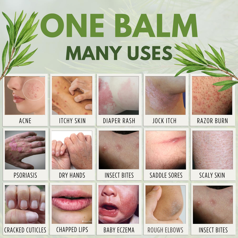 Gently applying TN NATURALS balm to irritated skin for soothing relief.