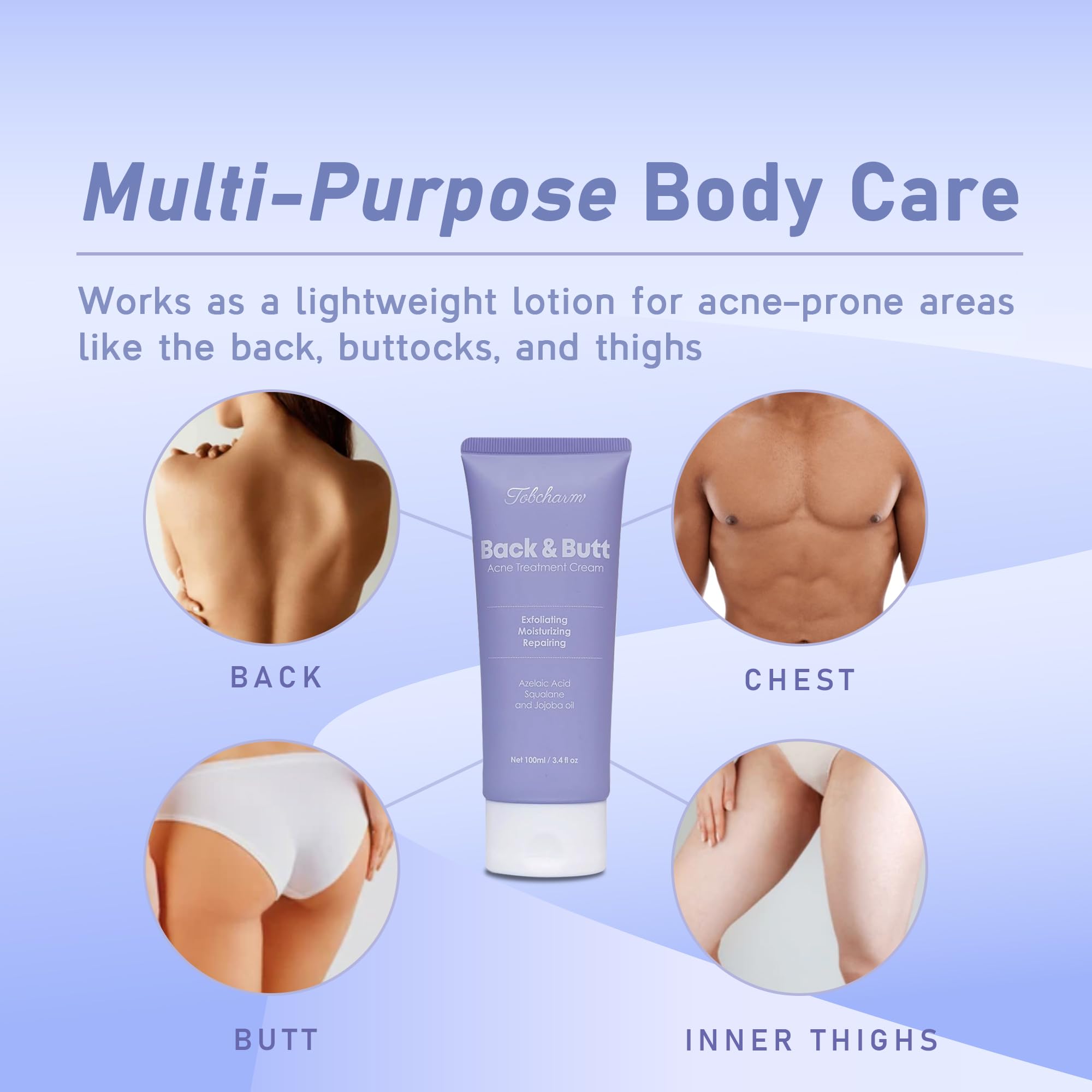 Tobcharm Travel-Size Acne Solution Pack ideal for on-the-go use