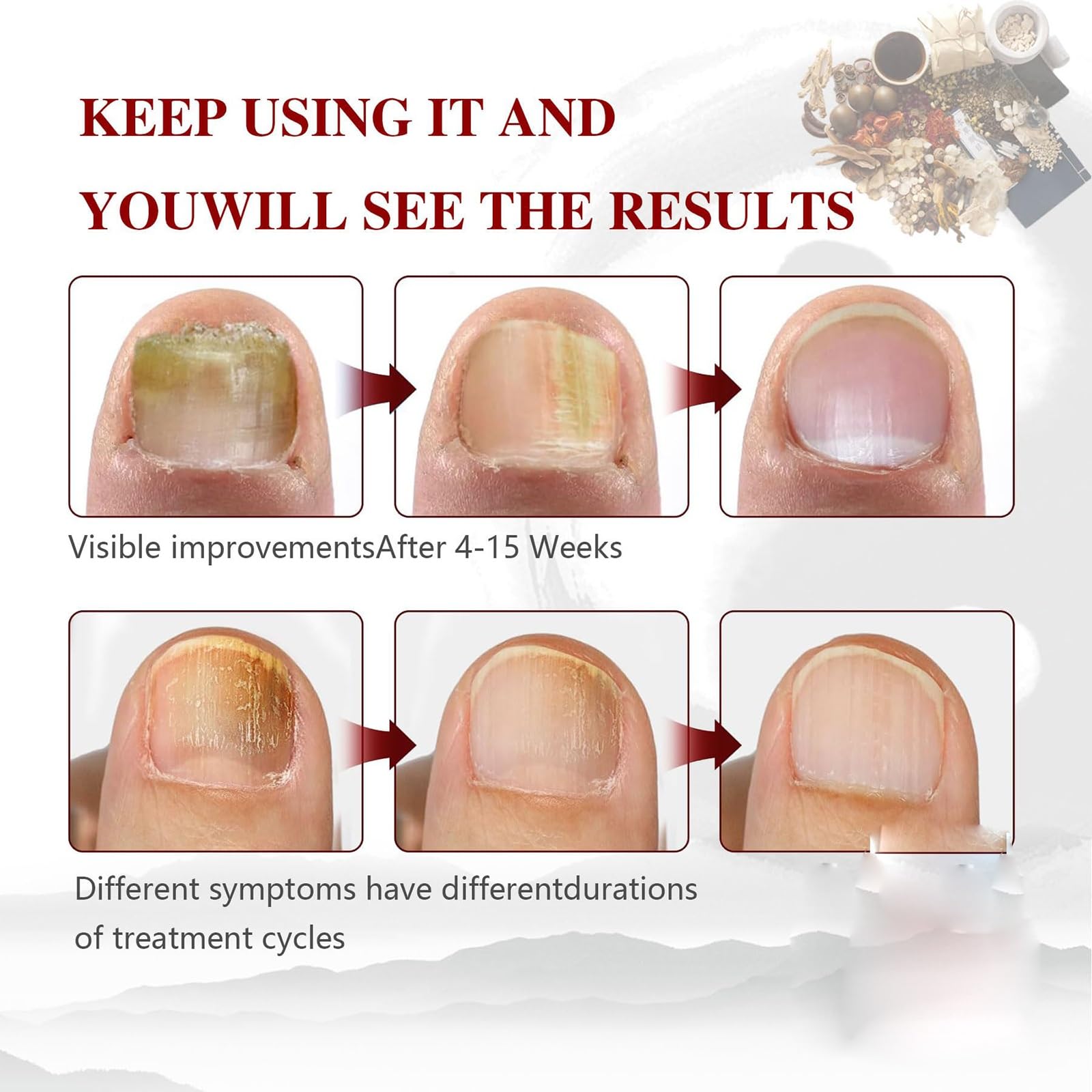Before-and-after look at nails after using Toenail Treatment for Discoloration.
