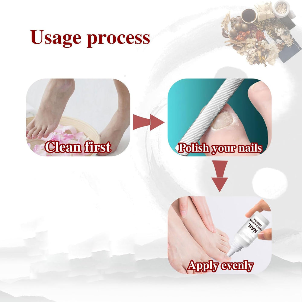 Progress toward healthier-looking nails with consistent use of Toenail Treatment for Discoloration.