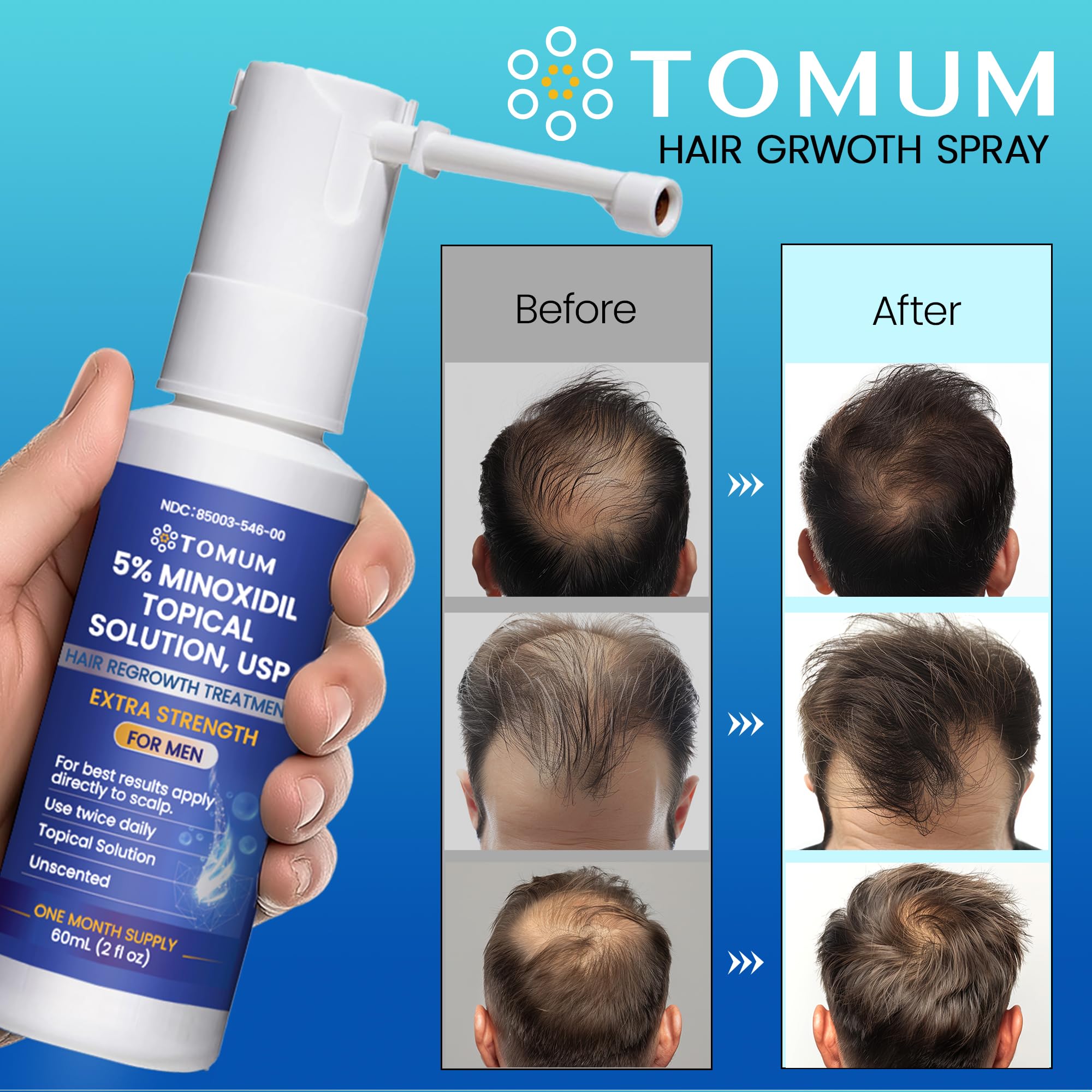 Non greasy finish of Tomum Minoxidil for all day comfort