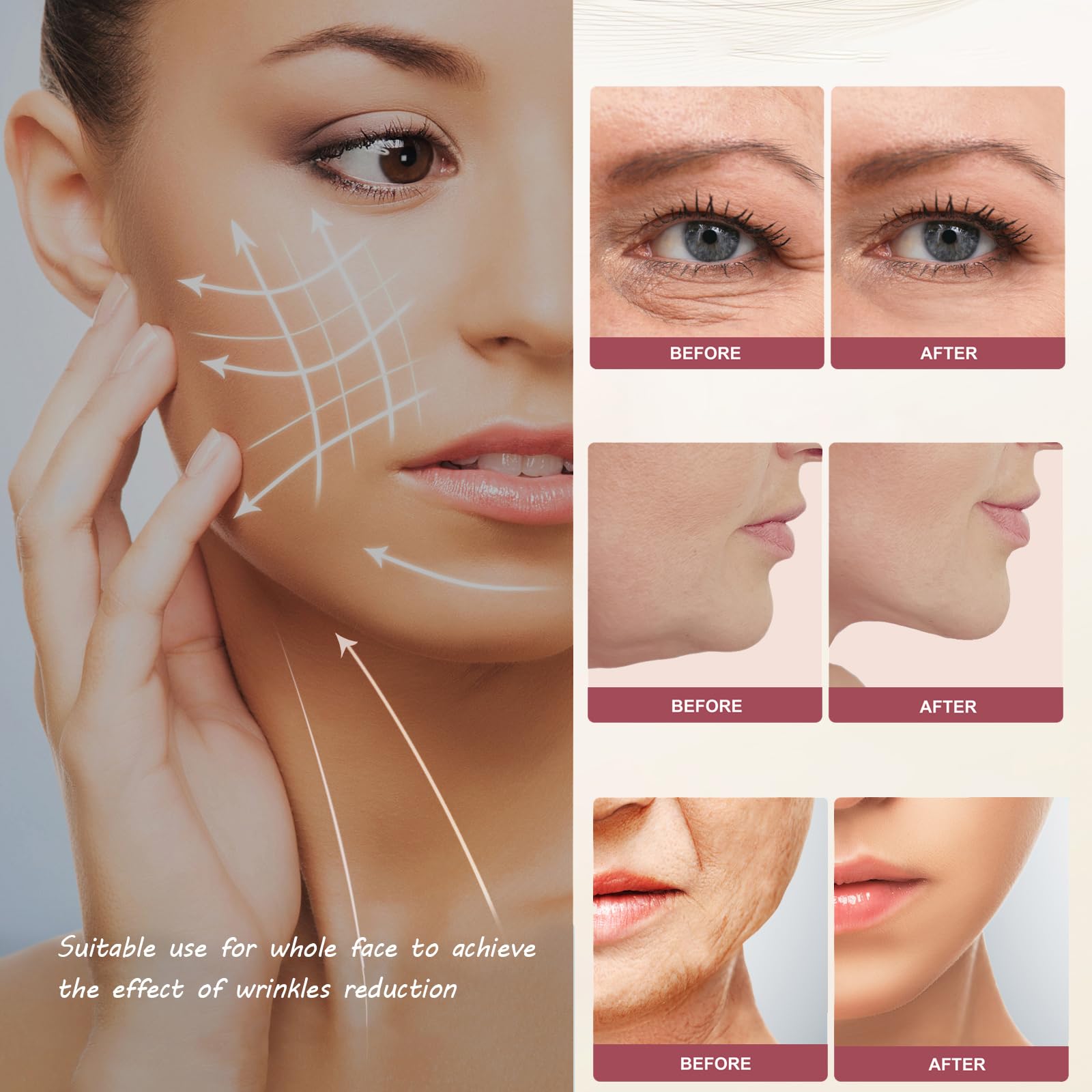 TONSPRER MZONG arms head for firming and contouring of upper arms.