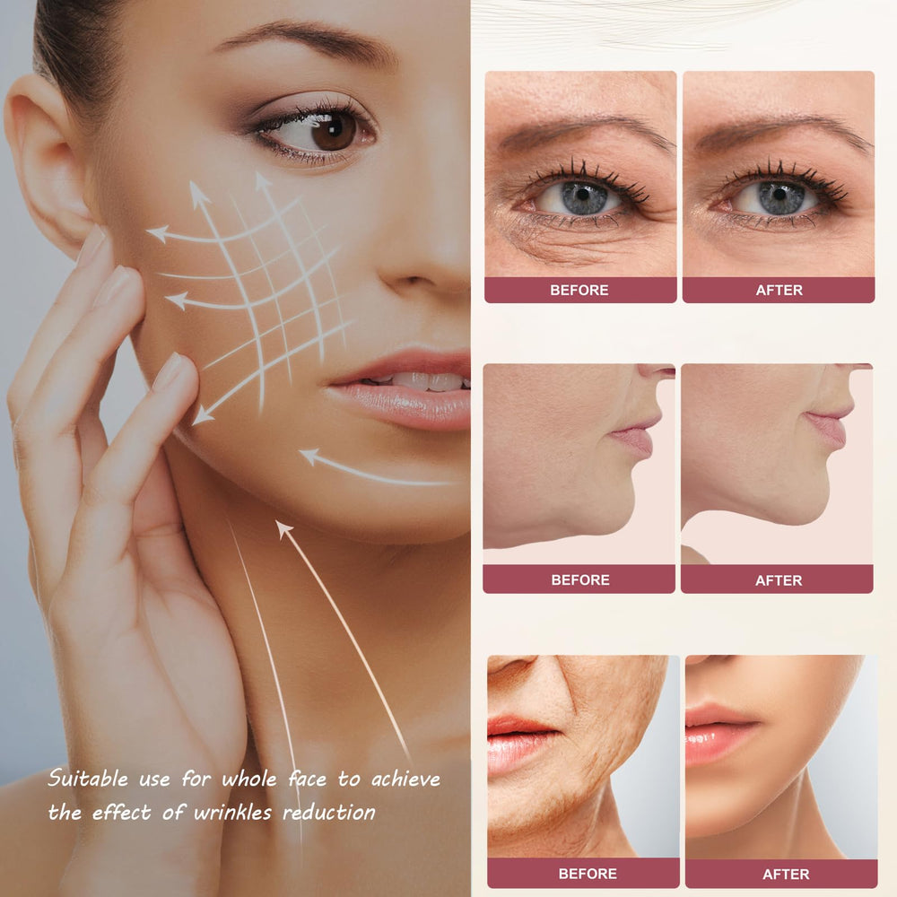 TONSPRER MZONG arms head for firming and contouring of upper arms.